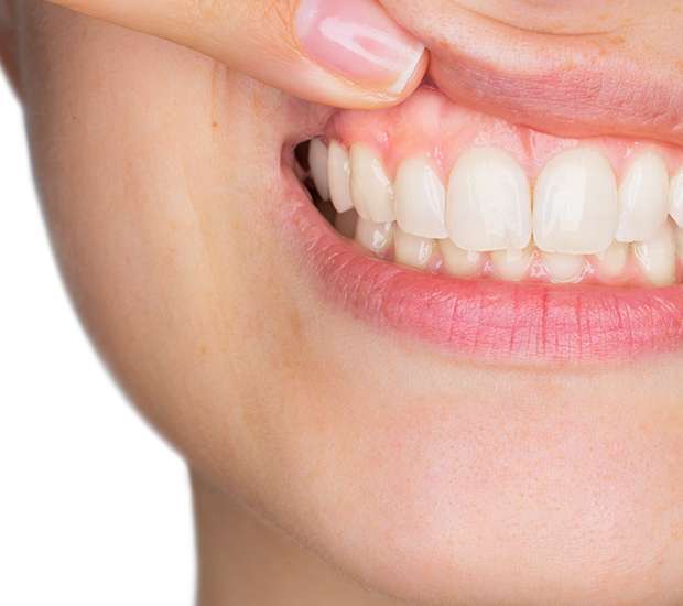 Gum Disease Treatment in Dundee, MI